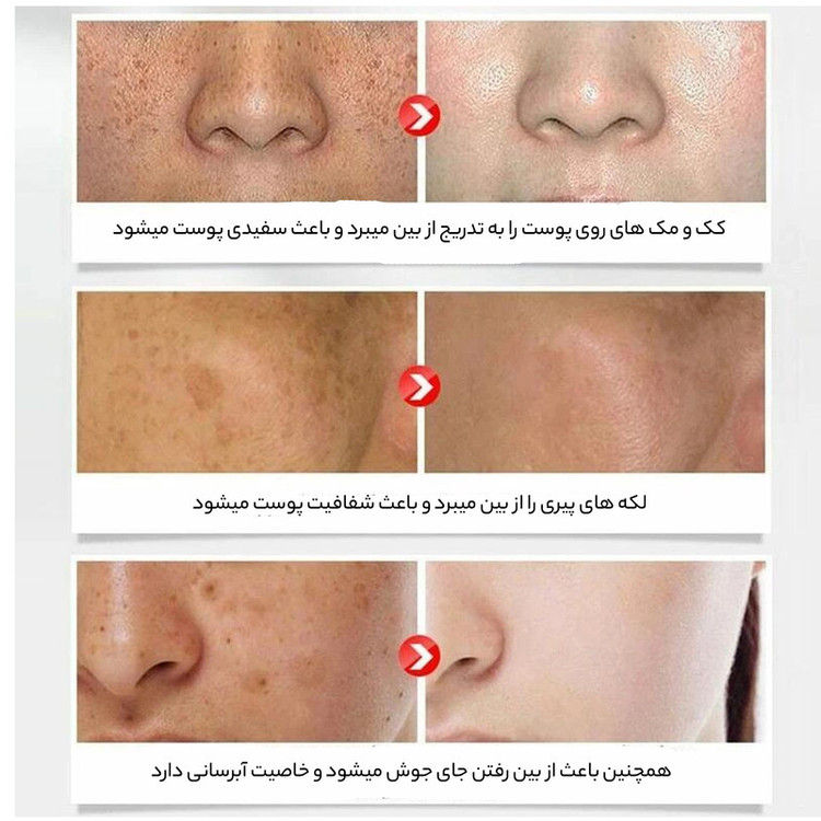 سرم پوست بایو آکوا مدل Rice Raw Pulp Hyaluronic Acid حجم 15 میلی لیتر