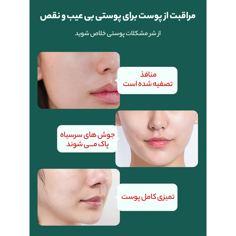 سرم ضد جوش وزه مدل Salicylic Acid حجم 30 میلی لیتر