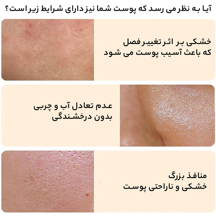 اسکراب لایه بردار پوست بایواکوا مدل Brightening Exfoliating Rice Gel حجم 140 میلی لیتر