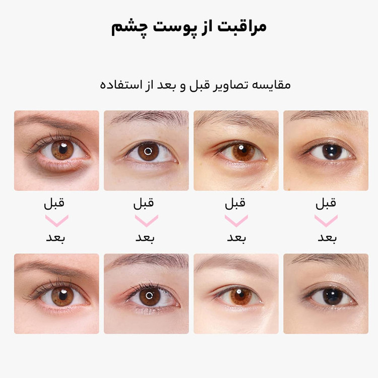 ماسک زیر چشم بایو آکوا مدل nonapeptide وزن 7.5 گرم